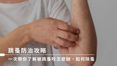 除跳蚤方法有哪些？認識跳蚤咬特徵&處理方式、3大殺跳蚤妙方！