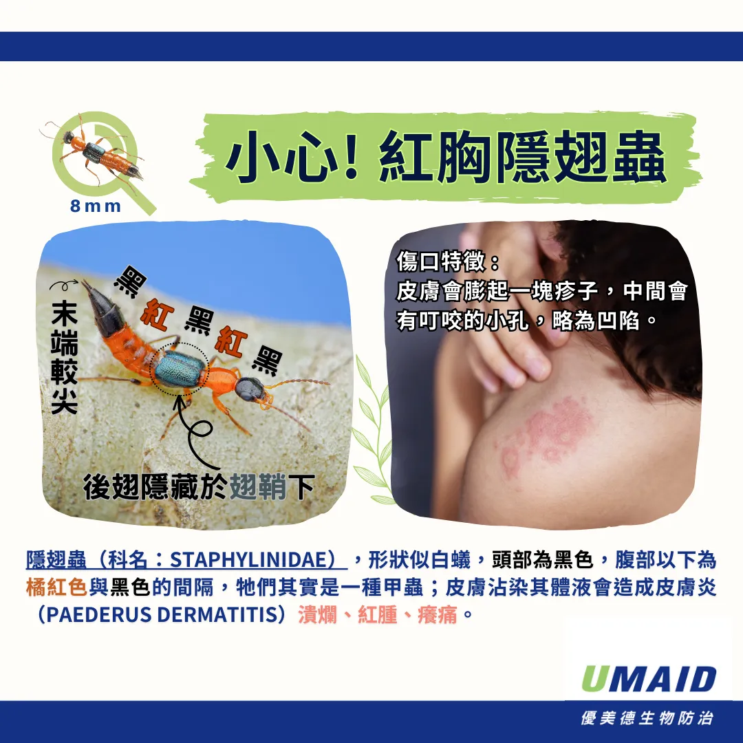 隱翅蟲會飛嗎 ??? 夏天常見的蟲蟲危機